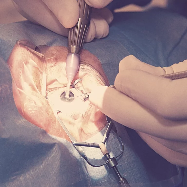 What Is A Cataract In The Eye?