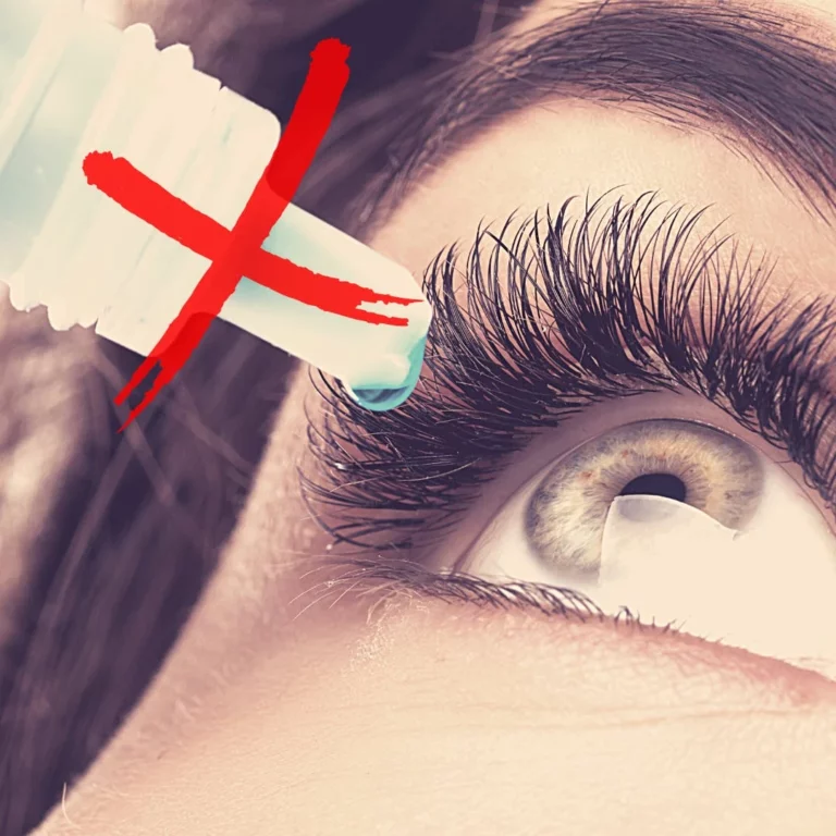 How To Treat Dry Eyes Without Drops