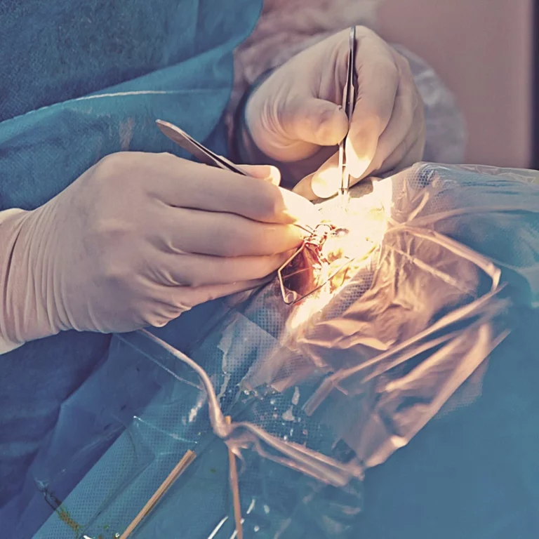 Cataract Surgery Lens Options