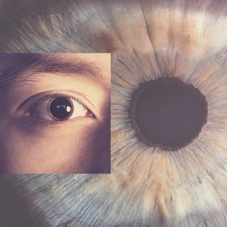 One Pupil Bigger Than Other?