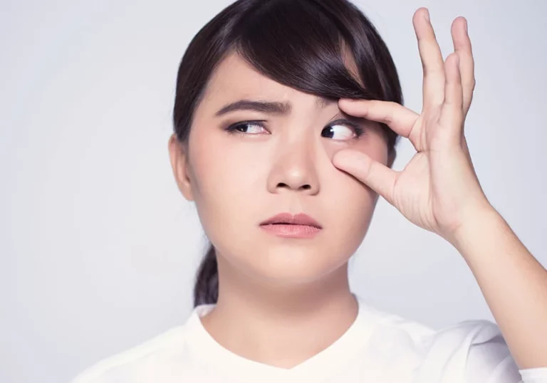 Contact Lens Stuck In Eye? What Should You Do?