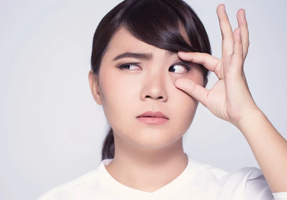 Contact Lens Stuck In Eye? What Should You Do? eyeFACTS