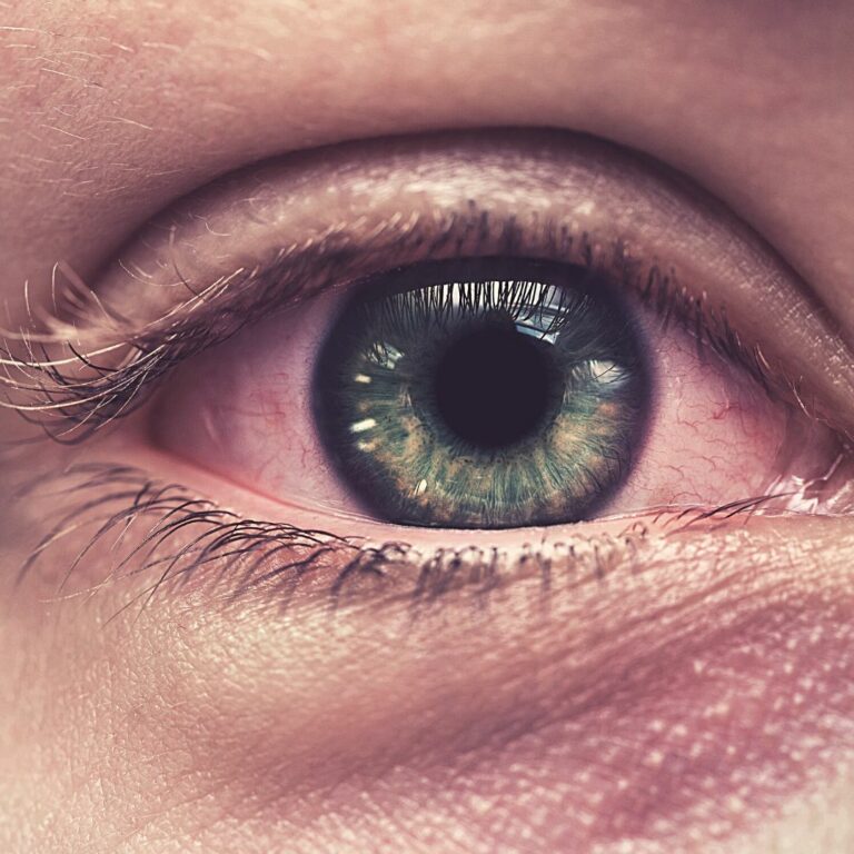 Why Does My Eye Feel Bruised When I Blink